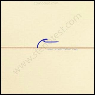 Stenography pattern for Local